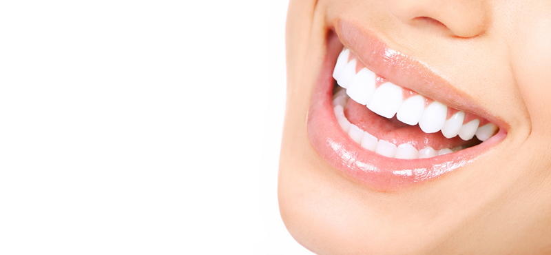 Invisalign clear braces Invisalign clear braces