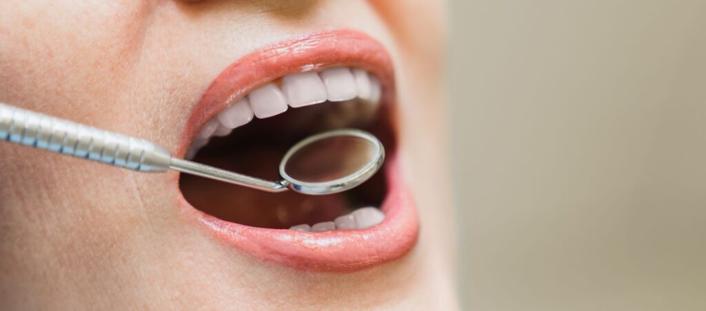 A woman's teeth being examined by a dental mirror.